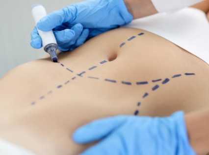 جراحة التجميل جراحة التجميل-biolifeclinic
