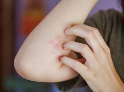 عياده جلديه عياده جلديه-biolifeclinic