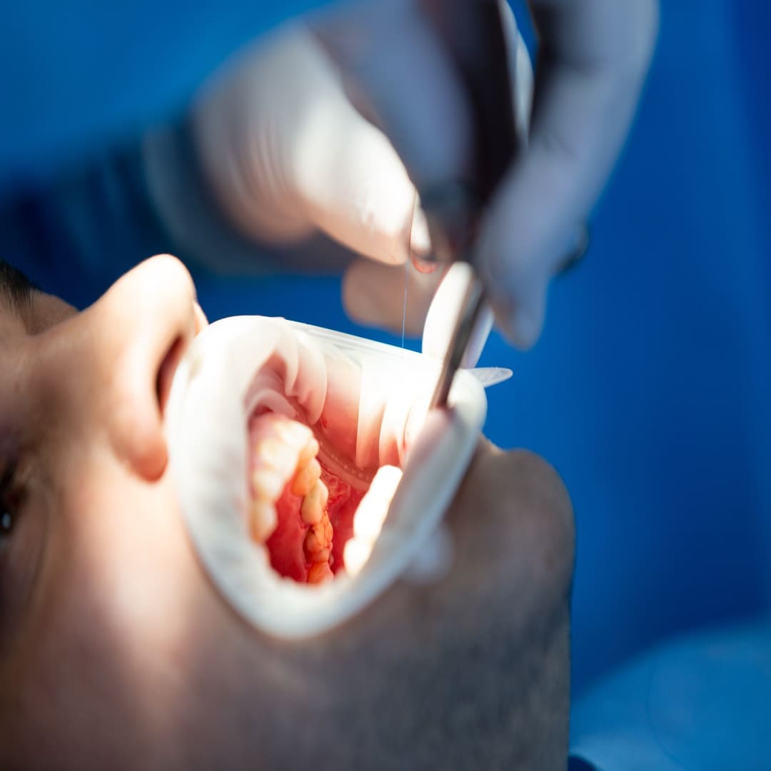 جراح أسنان