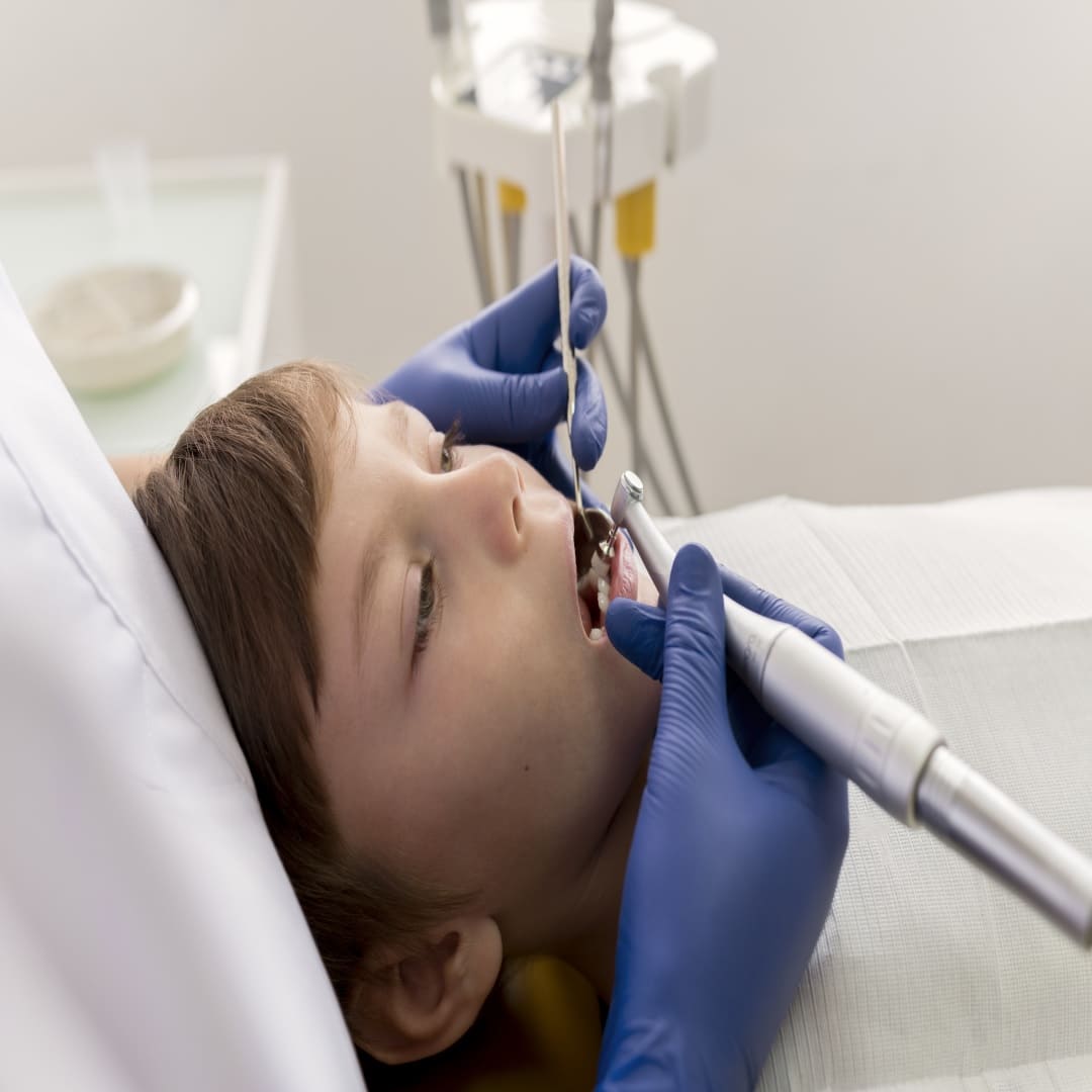 علاج تسوس اسنان الأطفال