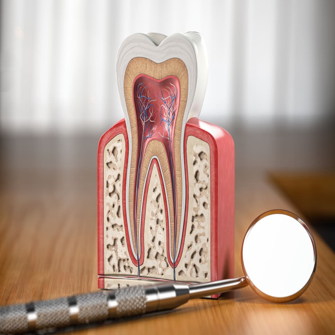 علاج عصب وجذور الأسنان