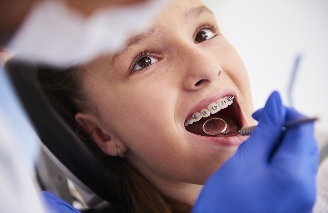 girl-with-braces-during-routine-dental-examination