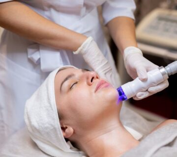 إزالة الشعر بالليزر -biolifeclinic
