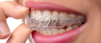 تقويم الأسنان