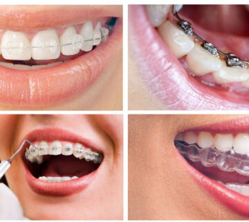 تقويم الأسنان