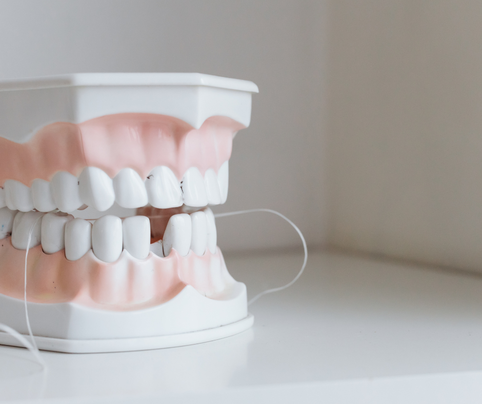 أفضل أنواع تركيبات الأسنان بجدة