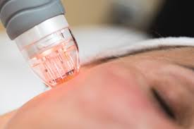 جهاز سكارليت