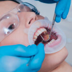 علاج عصب الأسنان