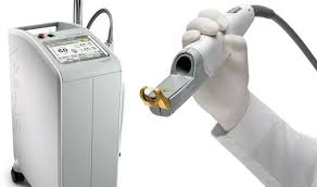 جهاز إليت ليزر