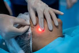 جهاز الاندولفت