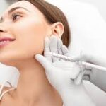 إبرة الريتش